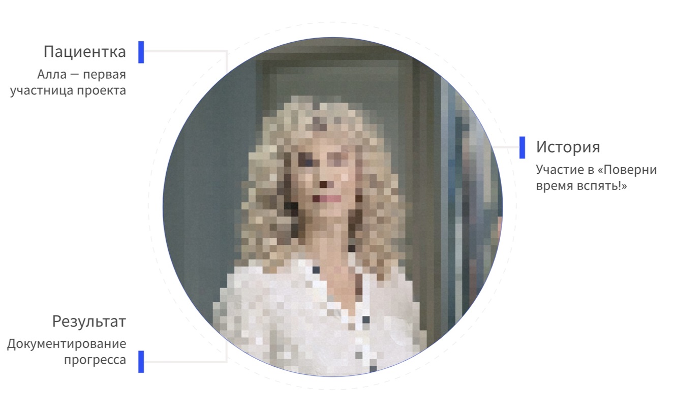 На фото: моя пациентка Алла - первый участник проекта «Поверни время вспять!»