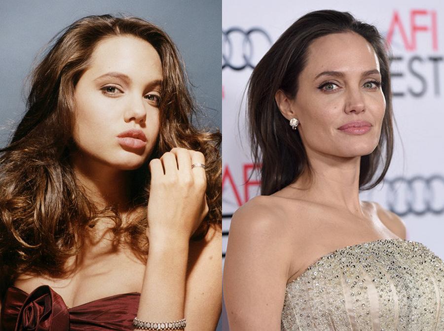Анжелин Джоли до и после ментопластики - пластики подбородка