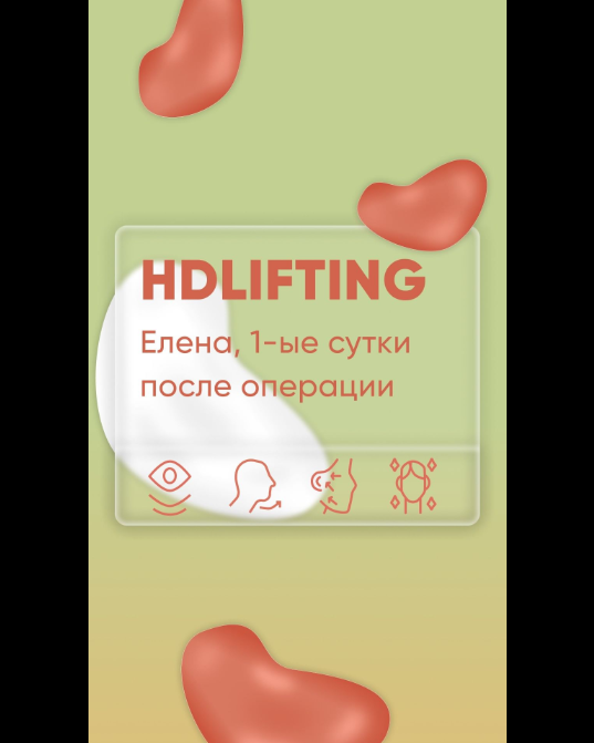 HD Lifting Елена 1 день после операции